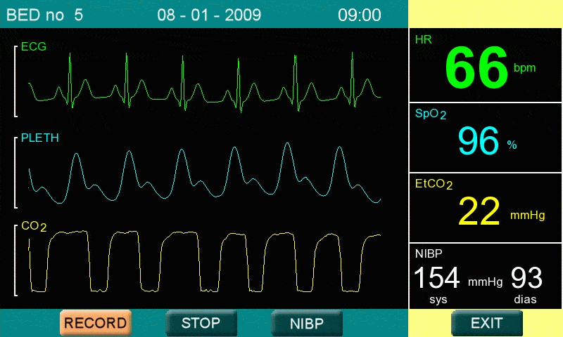 Patient Monitor